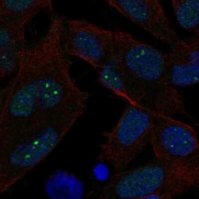 Immunocytochemistry/Immunofluorescence: Exonuclease 1 Antibody [NBP2-68889] - Staining of human cell line SH-SY5Y shows localization to nucleus & nuclear bodies.