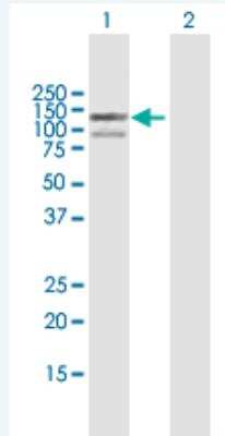 Western Blot: Exonuclease 1 Antibody [H00009156-B01P-50ug] - Analysis of EXO1 expression in transfected 293T cell line (H00009156-T01) by EXO1 MaxPab polyclonal antibody.  Lane 1: EXO1 transfected lysate(93.06 KDa). Lane 2: Non-transfected lysate.