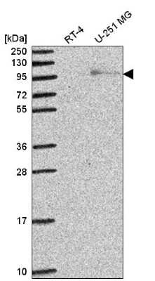 Western Blot: Exonuclease 1 Antibody [NBP2-58299] - Analysis in human cell line RT-4 and human cell line U-251 MG.