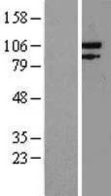 Western Blot: Exonuclease 1 Overexpression Lysate (Adult Normal) [NBP2-05746] Left-Empty vector transfected control cell lysate (HEK293 cell lysate); Right -Over-expression Lysate for Exonuclease 1.