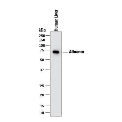 Exosome Detection (Western Blot) Antibody Pack [NBP3-11740] - Western blot shows lysate of human liver tissue. PVDF membrane was probed with 1 ug/mL of Mouse Anti-Human Serum Albumin Monoclonal Antibody (Catalog # MAB1455) followed by HRP-conjugated Anti-Mouse IgG Secondary Antibody (Catalog # HAF018). A specific band was detected for Albumin at approximately 65-70 kDa (as indicated). 