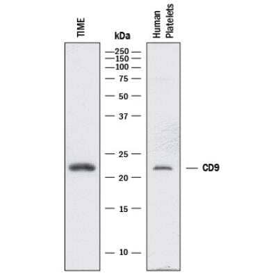 Western Blot: Exosome Detection (Western Blot) Antibody Pack [NBP3-11740] - Western blot shows lysates of TIME human endothelial cell line and human platelets. PVDF membrane was probed with 2 ug/mL of Mouse Anti-Human CD9 Monoclonal Antibody (Catalog # MAB25292) followed by HRP-conjugated Anti-Mouse IgG Secondary Antibody (Catalog # HAF018). A specific band was detected for CD9 at approximately 24 kDa (as indicated). 