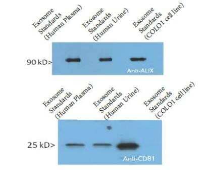 Western Blot: Exosome Standards (COLO1 cell line) [NBP2-49845] - Marker detection by Western Blotting. Reconstituted Exosomes can be directly lysed in Laemmli buffer, then loaded on the Electrophoresis gel. Recommended quantity: 10-20 ug per line.