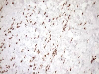 Immunohistochemistry: Exosome component 1 Antibody (1H9) [NBP2-45545] - Analysis of Human Ovary tissue. (Heat-induced epitope retrieval by 1mM EDTA in 10mM Tris buffer (pH8.5) at 120C for 3 min)