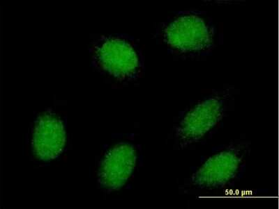 Immunocytochemistry/Immunofluorescence: Exosome component 1 Antibody [H00051013-B01P] - Analysis of purified antibody to EXOSC1 on HeLa cell. (antibody concentration 10 ug/ml)