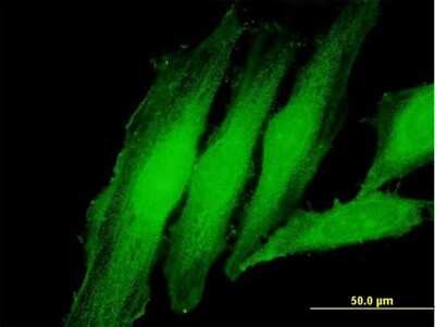 Immunocytochemistry/Immunofluorescence: Exosome component 1 Antibody [H00051013-B02P] - Analysis of purified antibody to EXOSC1 on HeLa cell. (antibody concentration 10 ug/ml)