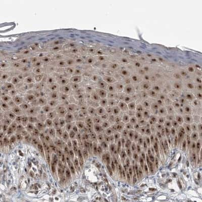 Immunohistochemistry-Paraffin: Exosome component 1 Antibody [NBP1-84523] - Staining of human vulva/anal skin shows strong nucleolar positivity in squamous epithelial cells.