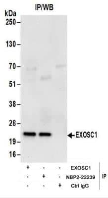 Immunoprecipitation: Exosome component 1 Antibody [NBP2-22239] - Whole cell lysate (1 mg for IP; 20% of IP loaded) from HeLa cells. Antibodies:  NBP2-22239 used for IP at 6 ug/mg lysate.  EXOSC1 was also immunoprecipitated by rabbit anti-EXOSC1 antibody.  For blotting immunoprecipitated EXOSC1, NBP2-22239  was used at 1 ug/ml.  Detection: Chemiluminescence with an exposure time of 30 seconds.