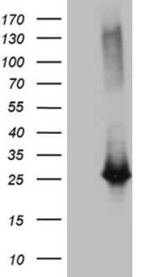 Western Blot: Exosome component 1 Antibody (OTI1H9) - Azide and BSA Free [NBP2-71895] - Analysis of HEK293T cells were transfected with the pCMV6-ENTRY control (Left lane) or pCMV6-ENTRY Exosome component 1.