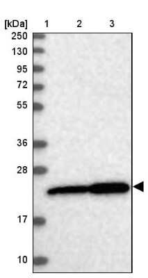 Western Blot: Exosome component 1 Antibody [NBP1-84523] - Lane 1: Marker  [kDa] 250, 130, 95, 72, 55, 36, 28, 17, 10.  Lane 2: Human cell line RT-4.  Lane 3: Human cell line U-251MG sp