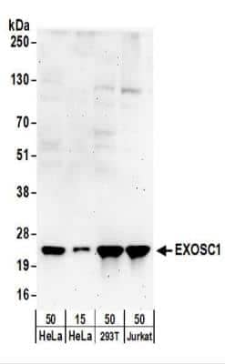 <b>Biological Strategies Validation. </b>Western Blot: Exosome component 1 Antibody [NBP2-22239] - Whole cell lysate from HeLa (15 and 50 ug), 293T (50 ug), and Jurkat (50 ug) cells. NBP2-22239 used for WB at 0.4 ug/ml.  Detection: Chemiluminescence with an exposure time of 3 minutes.