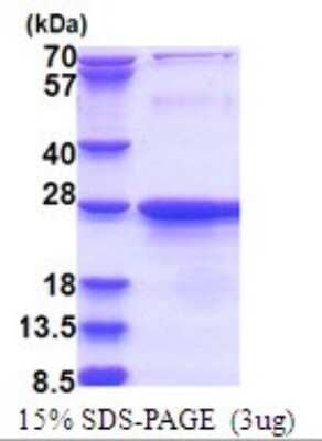 SDS-Page: Exosome component 1 Recombinant Protein [NBP2-51735] - 15% SDS Page (3 ug)