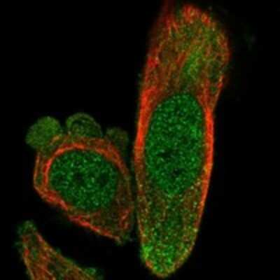 Immunocytochemistry/Immunofluorescence: Exosome component 4 Antibody [NBP3-17711] - Staining of human cell line PC-3 shows localization to nucleoplasm & cytosol.