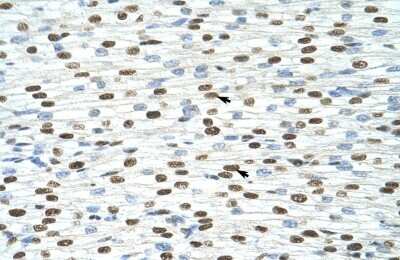 Immunohistochemistry-Paraffin: Exosome component 4 Antibody [NBP1-57180] - Human Heart Tissue, antibody concentration 4-8ug/ml. Cells with positive label: Myocardial cells (indicated with arrows) 400X magnification.