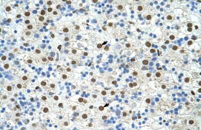 Immunohistochemistry-Paraffin: Exosome component 4 Antibody [NBP1-57180] - Human Liver Tissue, antibody concentration 4-8ug/ml. Cells with positive label: Hepatocytes (indicated with arrows) 400X magnification.