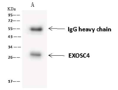 Immunoprecipitation: Exosome component 4 Antibody [NBP2-97799] - Exosome component 4 was immunoprecipitated using: Lane A: 0.5 mg HeLa Whole Cell Lysate 4 ul anti-Exosome component 4 rabbit polyclonal antibody and 60 ug of Immunomagnetic beads Protein A/G.  Primary antibody: Anti-Exosome component 4 rabbit polyclonal antibody, at 1:100 dilution. Secondary antibody: Goat Anti-Rabbit IgG (H+L)/HRP at 1/10000 dilution. Developed using the ECL technique. Performed under reducing conditions. Predicted band size: 26 kDa. Observed band size: 28 kDa