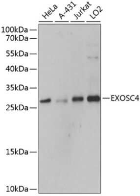 Western Blot: Exosome component 4 Antibody [NBP3-03385] - Analysis of extracts of various cell lines, using Exosome component 4 antibody at 1:3000 dilution. Secondary antibody: HRP Goat Anti-Rabbit IgG (H+L) at 1:10000 dilution. Lysates/proteins: 25ug per lane. Blocking buffer: 3% nonfat dry milk in TBST.