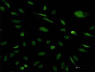 Immunocytochemistry/Immunofluorescence: Exosome component 5 Antibody (2E7) [H00056915-M03] - Analysis of monoclonal antibody to EXOSC5 on HeLa cell. Antibody concentration 10 ug/ml