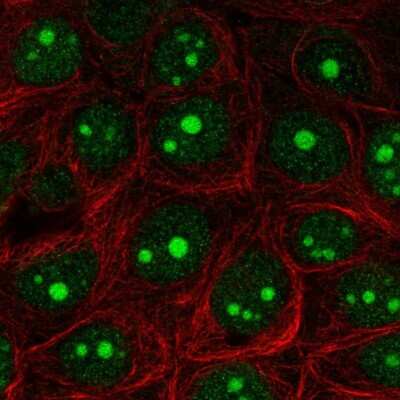 Immunocytochemistry/Immunofluorescence: Exosome component 5 Antibody [NBP2-56887] - Staining of human cell line MCF7 shows localization to nucleus & nucleoli.