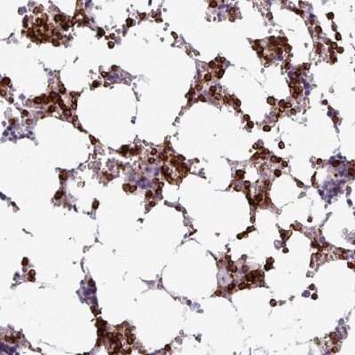 Immunohistochemistry: Exosome component 5 Antibody [NBP2-33677] - Staining of human bone marrow shows strong cytoplasmic positivity in hematopoietic cells.