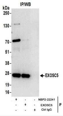 <b>Biological Strategies Validation. </b>Immunoprecipitation: Exosome component 5 Antibody [NBP2-22241] - Whole cell lysate (1 mg for IP; 20% of IP loaded) from 293T cells.  Antibodies: NBP2-22241 used for IP at 6 ug/mg lysate.  EXOSC5 was also immunoprecipitated by rabbit anti-EXOSC5 antibody.  For blotting immunoprecipitated EXOSC5, NBP2-22241 was used at 1 ug/ml.  Detection: Chemiluminescence with an exposure time of 10 seconds.