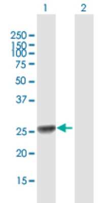 Western Blot: Exosome component 5 Antibody [H00056915-B01P] - Analysis of EXOSC5 expression in transfected 293T cell line by EXOSC5 polyclonal antibody.  Lane 1: EXOSC5 transfected lysate(25.85 KDa). Lane 2: Non-transfected lysate.