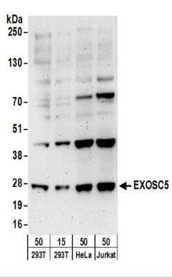 Western Blot: Exosome component 5 Antibody [NBP2-22241] - Whole cell lysate from 293T (15 and 50 ug), HeLa (50 ug), and Jurkat (50 ug) cells. NBP2-22241 used for WB at 0.1 ug/ml.  Detection: Chemiluminescence with an exposure time of 3 minutes.