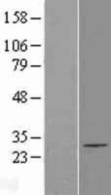 Western Blot: Exosome component 5 Overexpression Lysate (Adult Normal) [NBL1-10387] Left-Empty vector transfected control cell lysate (HEK293 cell lysate); Right -Over-expression Lysate for Exosome component 5.