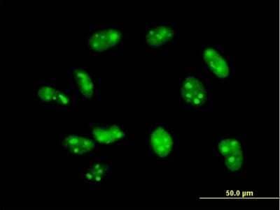 Immunocytochemistry/Immunofluorescence: Exosome component 7 Antibody [H00023016-B01P] - Analysis of purified antibody to EXOSC7 on HeLa cell. (antibody concentration 10 ug/ml)