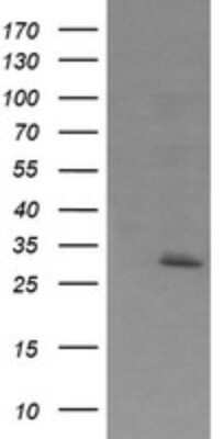 Western Blot: Exosome component 7 Antibody (OTI1E8) - Azide and BSA Free [NBP2-71720] - Analysis of HEK293T cells were transfected with the pCMV6-ENTRY control (Left lane) or pCMV6-ENTRY Exosome component 7.