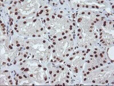 Immunohistochemistry: Exosome component 7 Antibody (OTI1G8) - Azide and BSA Free [NBP2-71722] - Staining of paraffin-embedded Human Kidney tissue using anti-Exosome component 7 mouse monoclonal antibody.