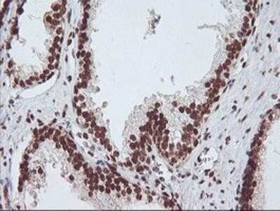 Immunohistochemistry: Exosome component 7 Antibody (OTI1G8) - Azide and BSA Free [NBP2-71722] - Staining of paraffin-embedded Human prostate tissue using anti-Exosome component 7 mouse monoclonal antibody.