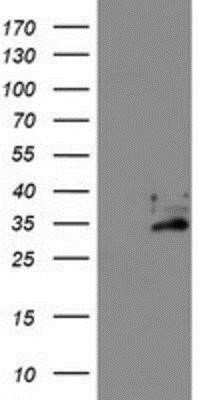 Western Blot: Exosome component 7 Antibody (OTI1G8) - Azide and BSA Free [NBP2-71722] - HEK293T cells were transfected with the pCMV6-ENTRY control (Left lane) or pCMV6-ENTRY Exosome component 7 (Right lane) cDNA for 48 hrs and lysed. Equivalent amounts of cell lysates (5 ug per lane) were separated by SDS-PAGE and immunoblotted with anti-Ex