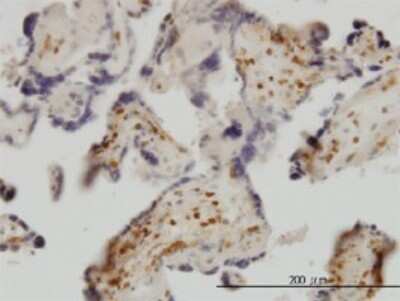 Immunohistochemistry-Paraffin: Exosome component 8 Antibody (1G5) [H00011340-M01] - Analysis of monoclonal antibody to EXOSC8 on formalin-fixed paraffin-embedded human placenta. Antibody concentration 3 ug/ml.