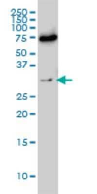 Western Blot: Exosome component 8 Antibody (1G5) [H00011340-M01] - EXOSC8 monoclonal antibody (M01), clone 1G5 Analysis of EXOSC8 expression in Hela S3 NE.