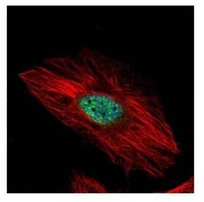 Immunocytochemistry/Immunofluorescence: Exosome component 8 Antibody [NBP2-14953] - Analysis of methanol-fixed HeLa, using EXOSC8 antibody (Green) at 1:500 dilution. Alpha-tubulin filaments were labeled with an alpha Tubulin antibody (Red) at 1:2000.