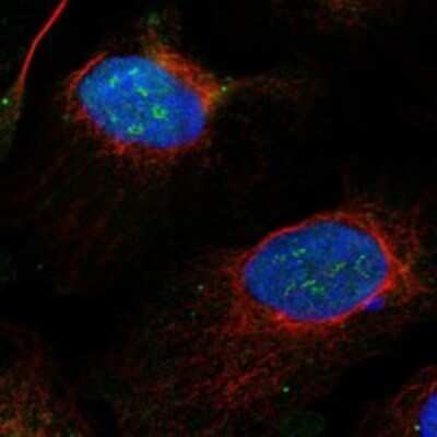 Immunocytochemistry/Immunofluorescence: Exosome component 8 Antibody [NBP3-17842] - Staining of human cell line U-2 OS shows localization to nucleoplasm, nucleoli fibrillar center & mitotic chromosome.