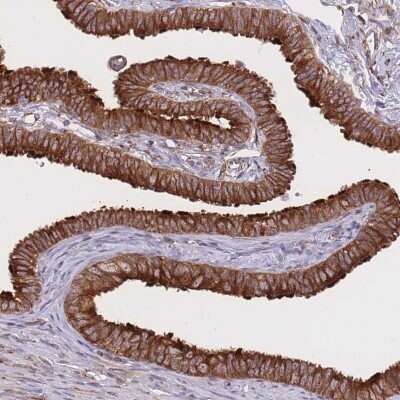 <b>Genetic Strategies Validation. </b>Immunohistochemistry-Paraffin: Exosome component 8 Antibody [NBP2-47465] - Staining of human fallopian tube shows cytoplasmic and membranous positivity in glandular cells.