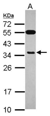 Western Blot: Exosome component 8 Antibody [NBP2-14953] - Sample (30 ug of whole cell lysate) A: HepG2 12% SDS PAGE; antibody diluted at 1:1000.