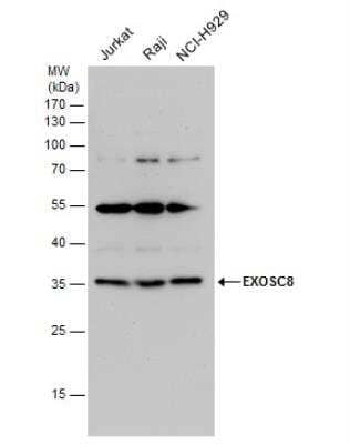 Western Blot: Exosome component 8 Antibody [NBP2-14953] - Various whole cell extracts (30 ug) were separated by 12% SDS-PAGE, and the membrane was blotted with EXOSC8 antibody diluted by 1:1000.