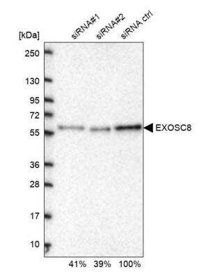 Western Blot: Exosome component 8 Antibody [NBP2-47465] - Analysis in U2OS cells transfected with control siRNA, target specific siRNA probe #1 and #2. Remaining relative intensity is presented.