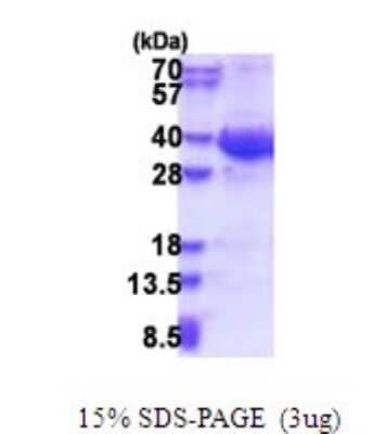 SDS-Page: Exosome component 8 Recombinant Protein [NBP2-51642] - 15% SDS Page (3 ug)