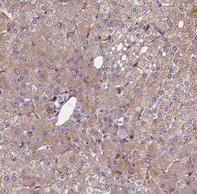 Immunohistochemistry-Paraffin: Exostosin 1 Antibody [NBP1-91875] - Staining of human liver shows moderate cytoplasmic positivity in hepatocytes.