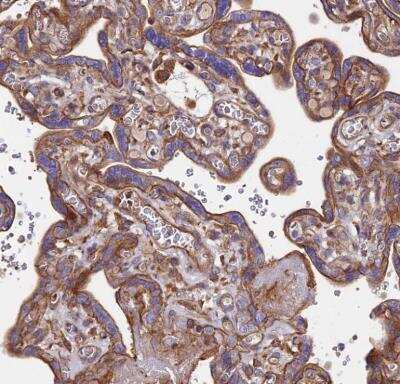 Immunohistochemistry-Paraffin: Exostosin 1 Antibody [NBP1-91875] - Staining of human placenta shows moderate ctyoplasmic positivity in trophoblastic cells.