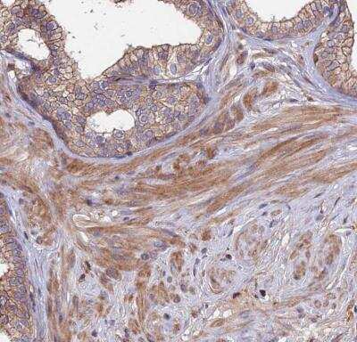 Immunohistochemistry-Paraffin: Exostosin 1 Antibody [NBP1-91875] - Staining of human prostate shows moderate cytoplasmic positivity in smooth muscle cells.