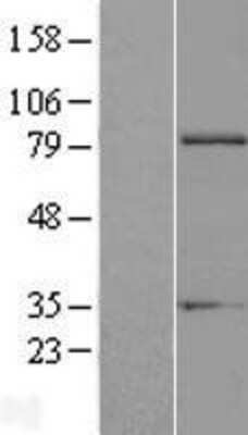 Western Blot: Exostosin 1 Overexpression Lysate (Adult Normal) [NBL1-10391] Left-Empty vector transfected control cell lysate (HEK293 cell lysate); Right -Over-expression Lysate for Exostosin 1.