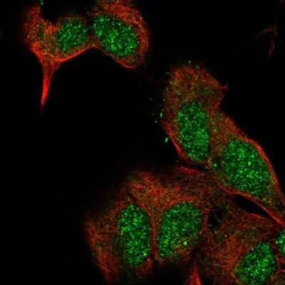 Immunocytochemistry/Immunofluorescence: Exostosin-like 2/EXTL2 Antibody [NBP2-56467] - Staining of human cell line SH-SY5Y shows localization to nucleus & cytosol.