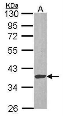 Western Blot Exostosin-like 2/EXTL2 Antibody