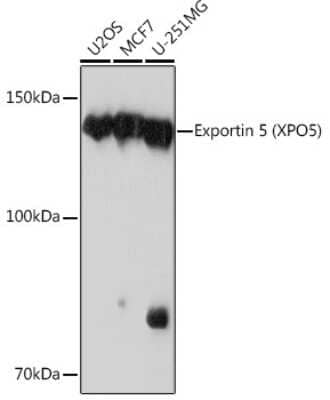 Western Blot: Exportin-5 Antibody (3Q8E6) [NBP3-16278] - Western blot analysis of extracts of various cell lines, using Exportin-5 (XPO5) Rabbit mAb (NBP3-16278) at 1:1000 dilution. Secondary antibody: HRP Goat Anti-Rabbit IgG (H+L) at 1:10000 dilution. Lysates/proteins: 25ug per lane. Blocking buffer: 3% nonfat dry milk in TBST. Detection: ECL Basic Kit. Exposure time: 30s.