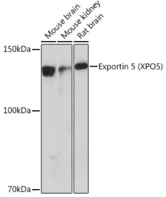 Western Blot: Exportin-5 Antibody (3Q8E6) [NBP3-16278] - Western blot analysis of extracts of various cell lines, using Exportin-5 (XPO5) Rabbit mAb (NBP3-16278) at 1:1000 dilution. Secondary antibody: HRP Goat Anti-Rabbit IgG (H+L) at 1:10000 dilution. Lysates/proteins: 25ug per lane. Blocking buffer: 3% nonfat dry milk in TBST. Detection: ECL Basic Kit. Exposure time: 90s.